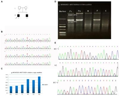 Two novel SUCLA2 variants cause mitochondrial DNA depletion syndrome, type 5 in two siblings